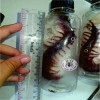 CENTIPEDE